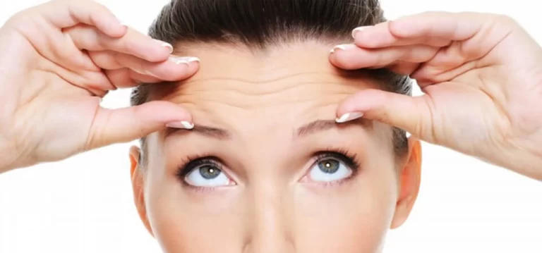 Mini Forehead Lift