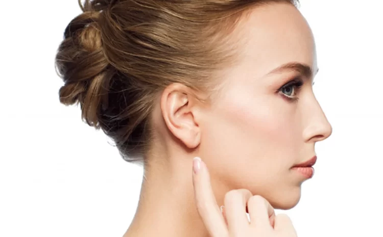 Otoplasty