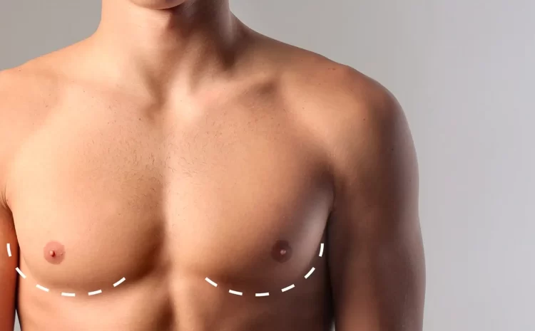 Gynecomastia (Male Breast Reduction) Surgery