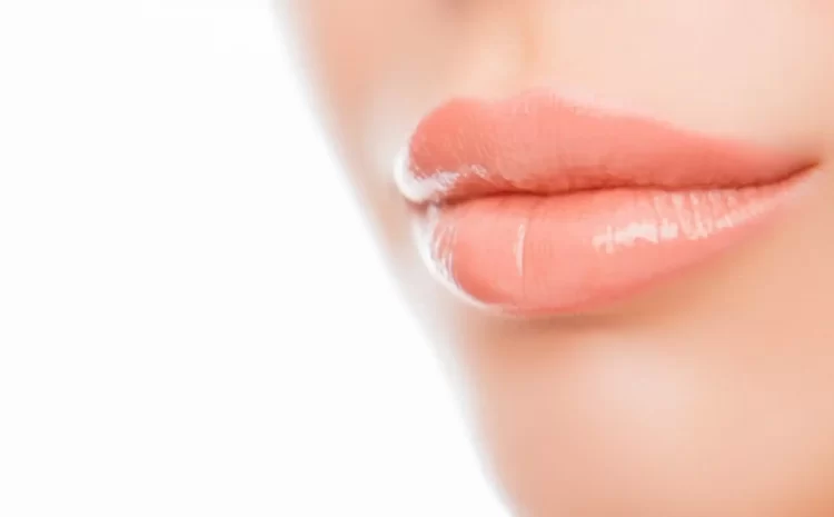 Lip Lift