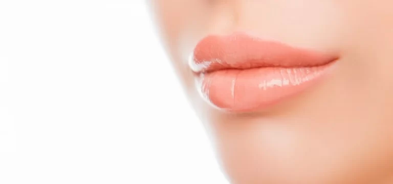 Lip Lift