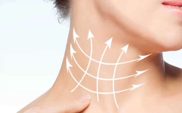 Neck Lift