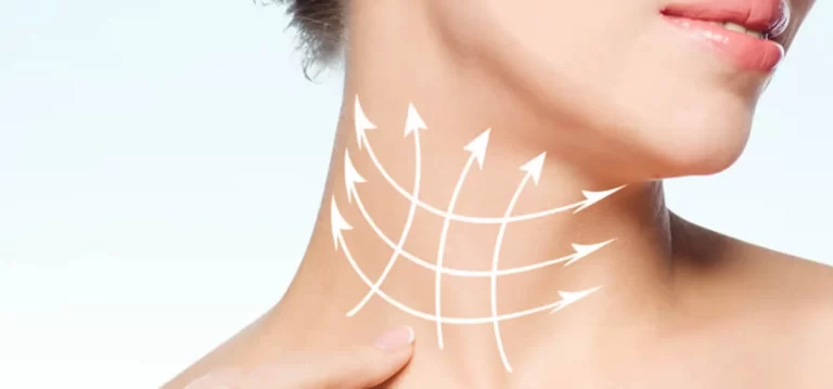 Neck Lift
