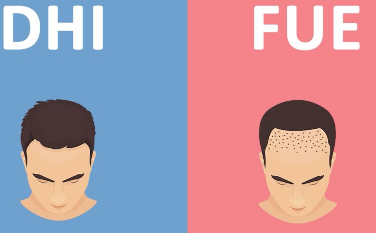 FUE and DHI Hair Transplant: Which is Right for You?
